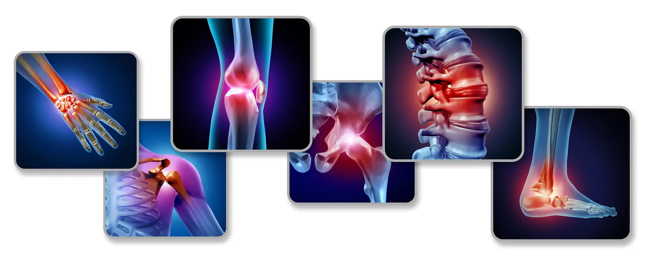 Let’s Fight Against Arthritis