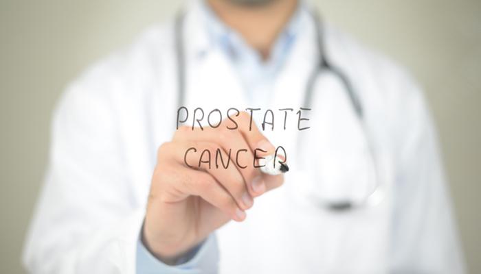 Prostate Cancer- Symptoms, Causes, & Treatment?