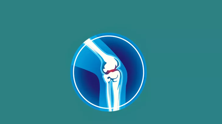 Partial vs Total Knee Replacement: Which one is right for you?