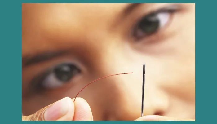How Safe Is Squint Surgery?