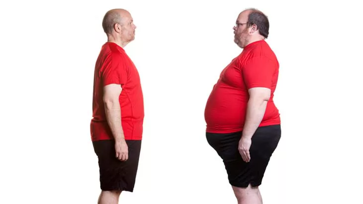 Weight loss: bypass vs. banding surgery