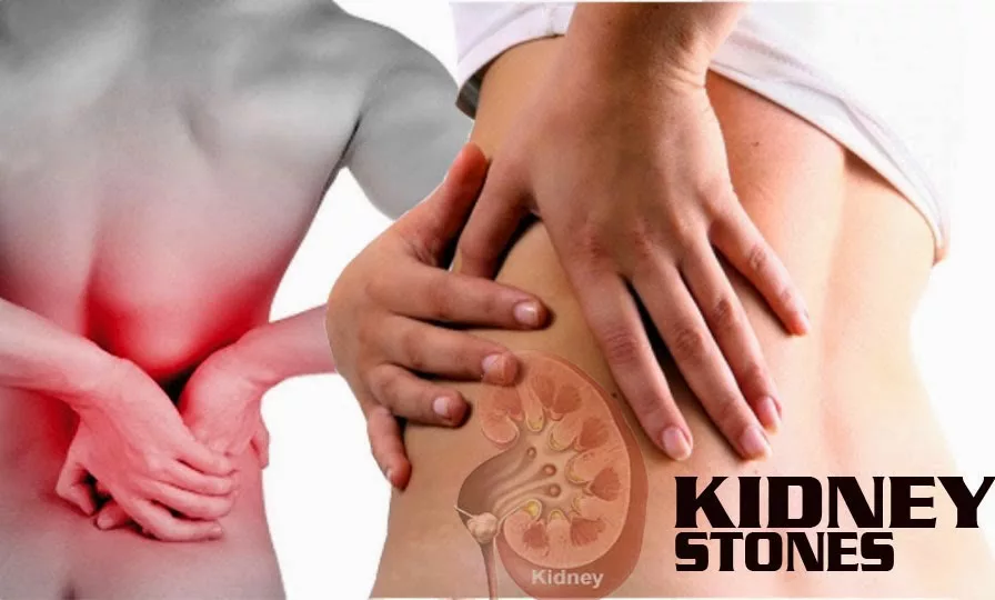 Latest Non-Invasive Surgical Intervention for Kidney Stones