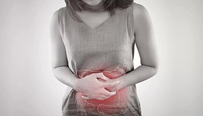 Irritable Bowel Syndrome (IBS) بابت توهان کي ڄاڻڻ جي ضرورت آهي