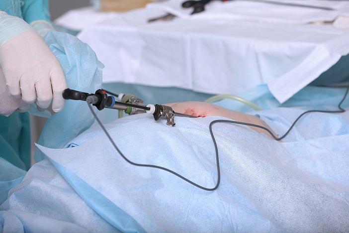 Chirurgie laparoscopique de la hernie