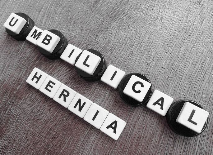 10 سوال پڇڻ لاءِ توھان جي سرجن کان پھريائين ھڪ Umbilical Hernia مرمت ڪرائڻ