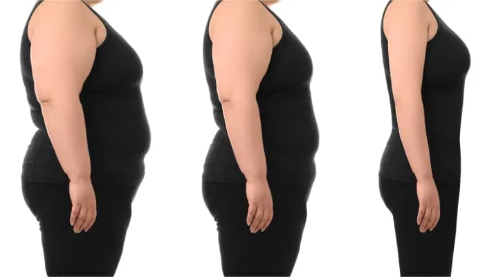 Comment le ballon gastrique Apollo peut vous aider à démarrer votre parcours de perte de poids