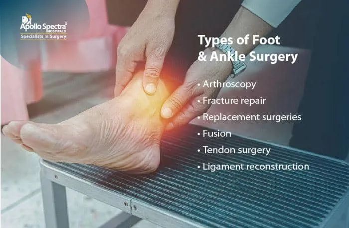 足と足首の手術が必要ですか - 兆候とその必要性?