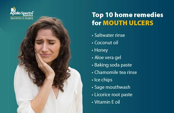 口内炎に対する家庭療法トップ10