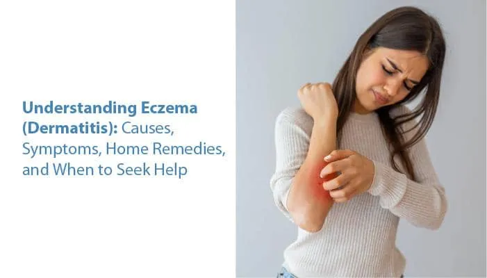 Comprendre l'eczéma (dermatite) : causes, symptômes, remèdes maison et quand demander de l'aide