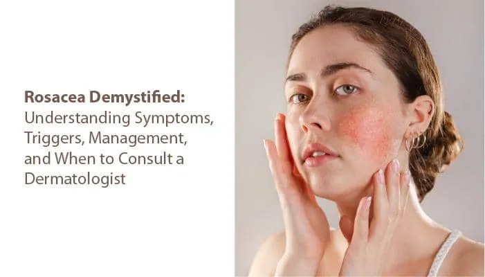 Rosacea Demystified: Understanding Symptoms, Triggers, Management, and When to Consult a Dermatologist