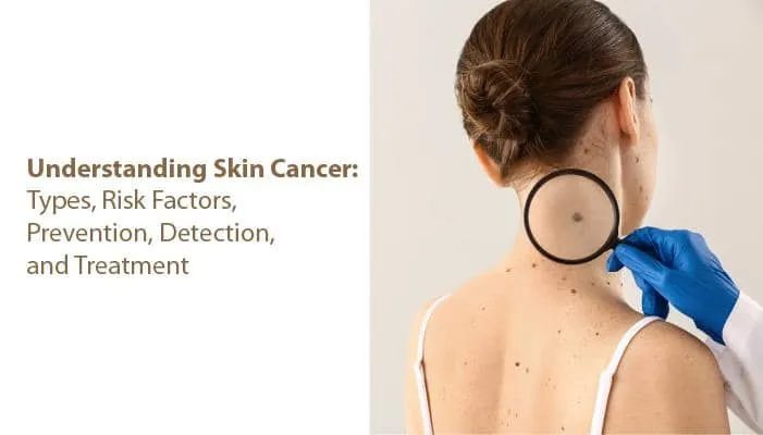 Understanding Skin Cancer: Types, Risk Factors, Prevention, Detection, and Treatment