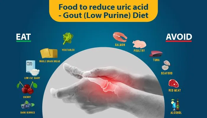 Régime goutte (acide urique) : aliments à manger et ceux à éviter