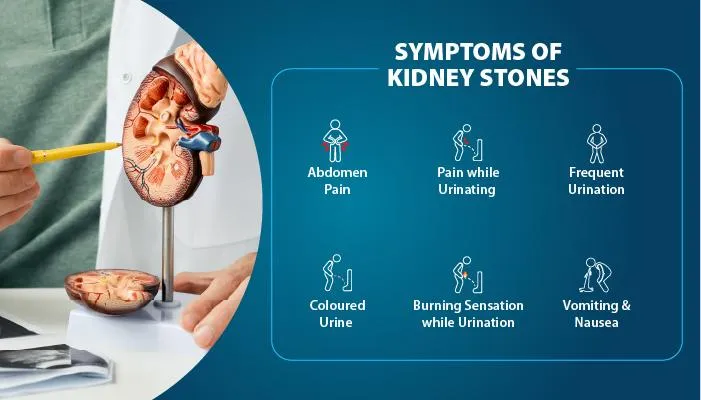 What Size of Kidney Stone Requires Surgery?