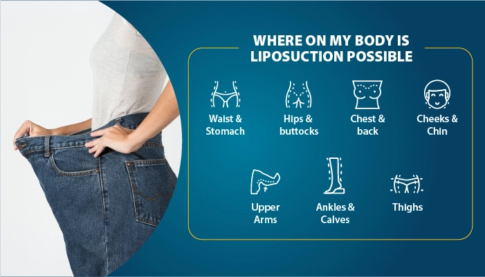 Liposuction