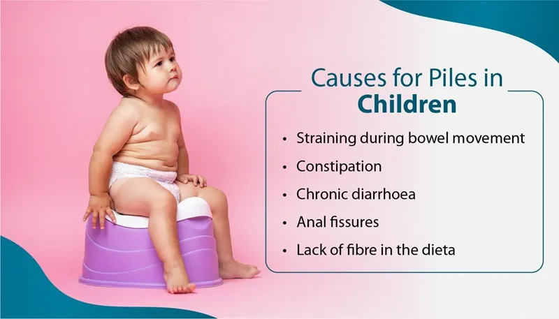 बालबालिकामा पाइल्स - सामान्य कारण, लक्षण र समाधान