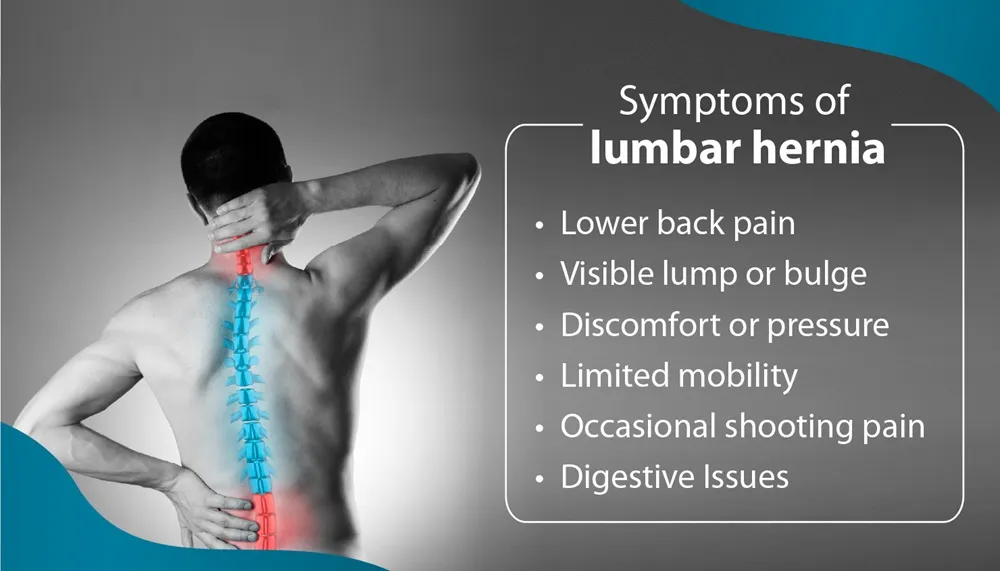 Know More About Lumbar Hernia, Causes and Treatment