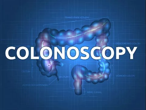 Coloscopie : préparation et directives pour la procédure