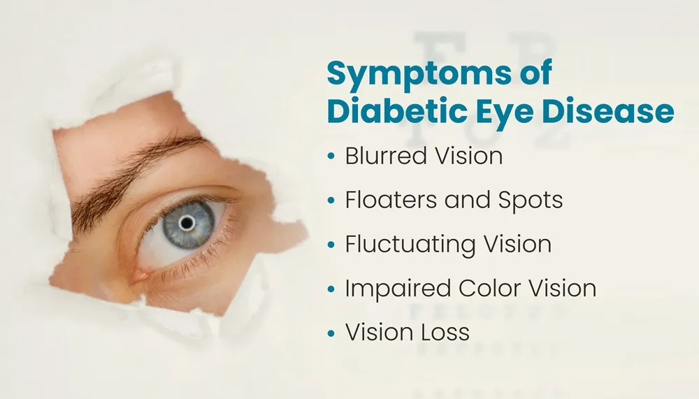 糖尿病性網膜症: 糖尿病の合併症から目を守る