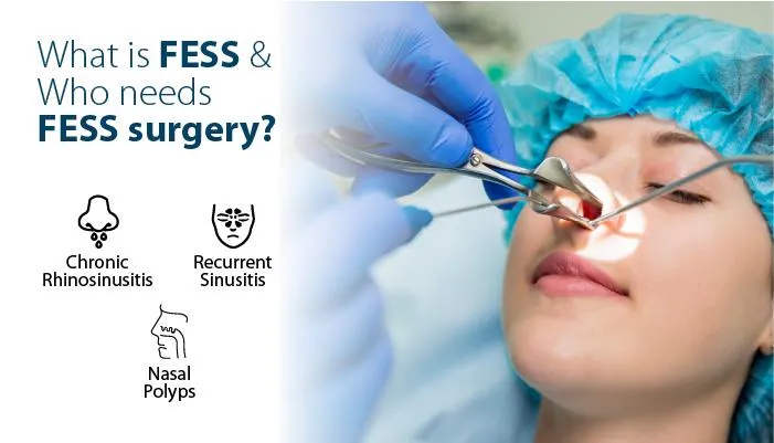 Fess Surgery
