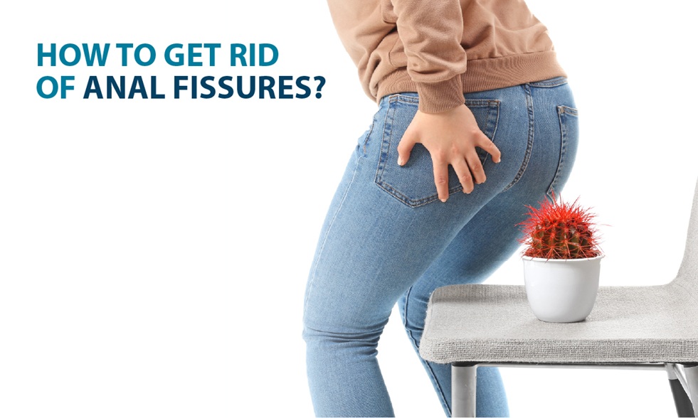 How to Get Rid of Anal Fissures?