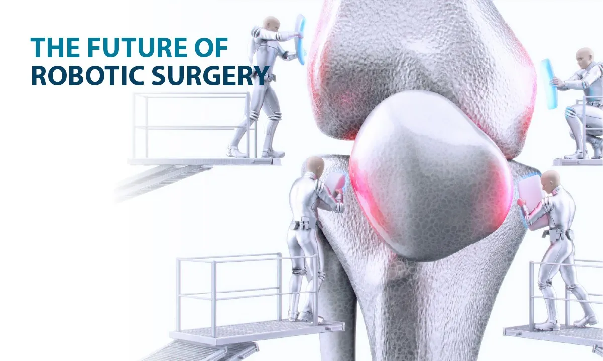 Advancements in Robotic Surgery: What Patients Need to Know