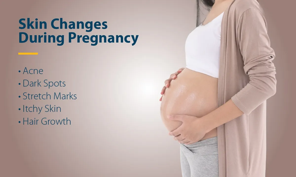 Skin Changes During Pregnancy