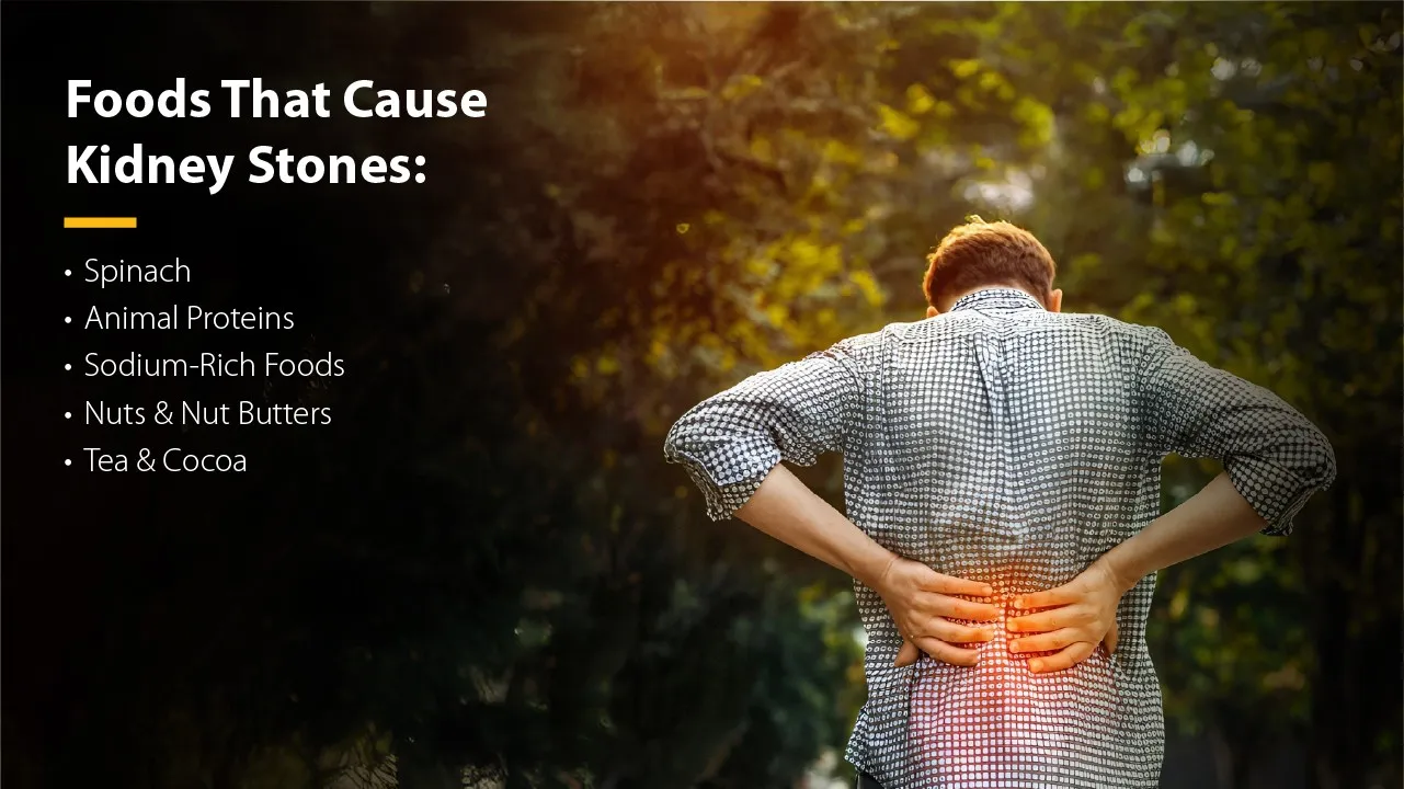 Foods That Cause Kidney Stones