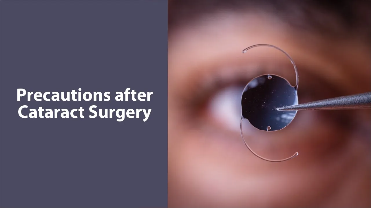 Precautions After Cataract Surgery