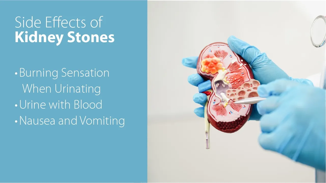 Side Effects of Kidney Stones