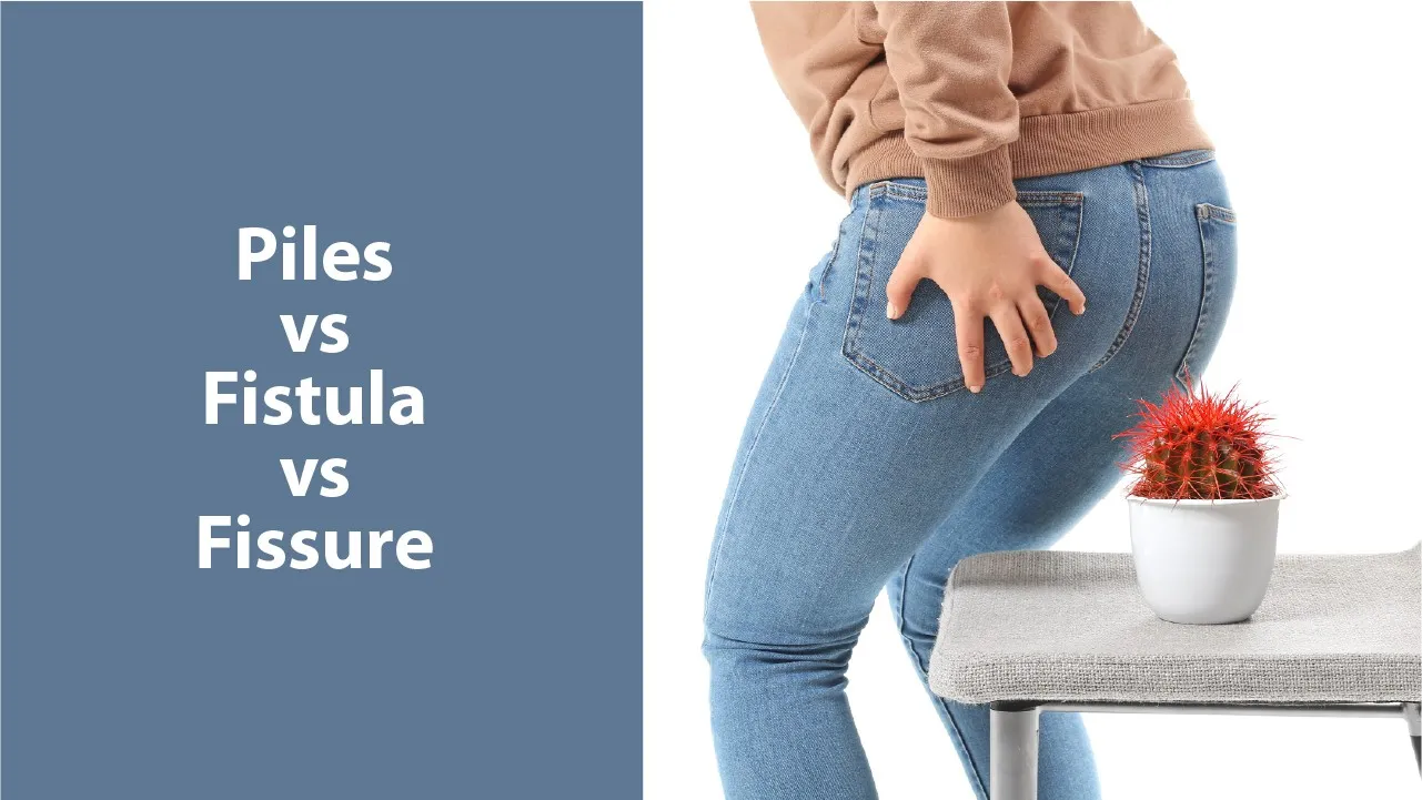 Piles Vs Fistula Vs Fissures