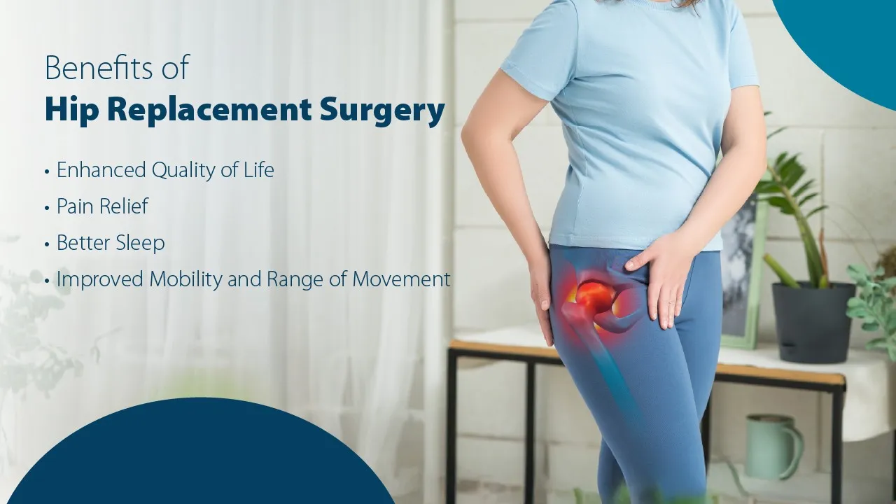 Benefits of Hip Replacement Surgery