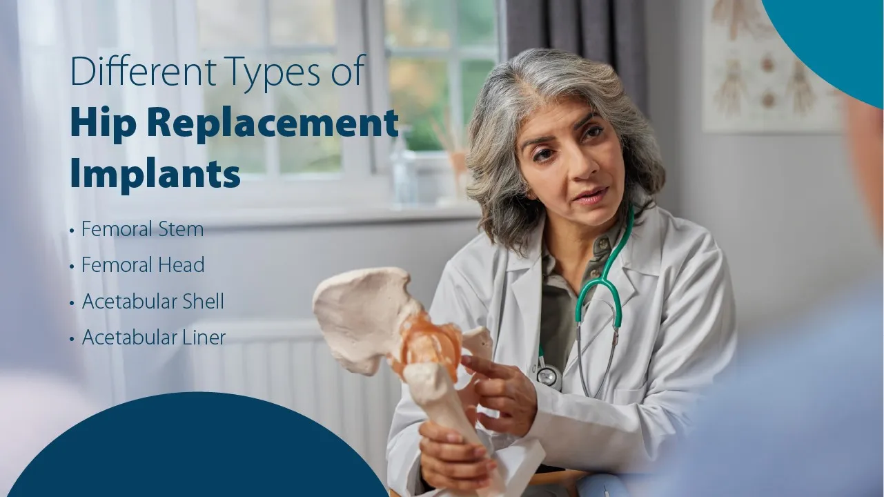 Different Types of Hip Replacement Implants