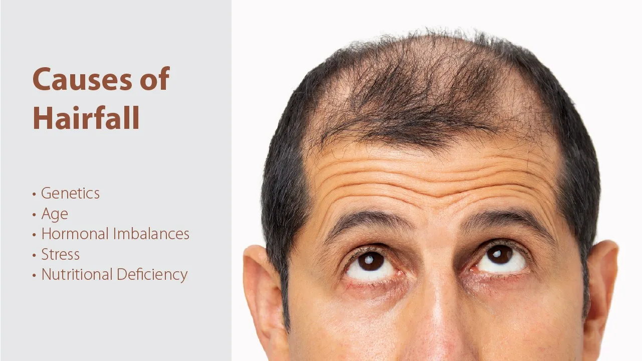 8 Common Causes of Hairfall & Their Solutions