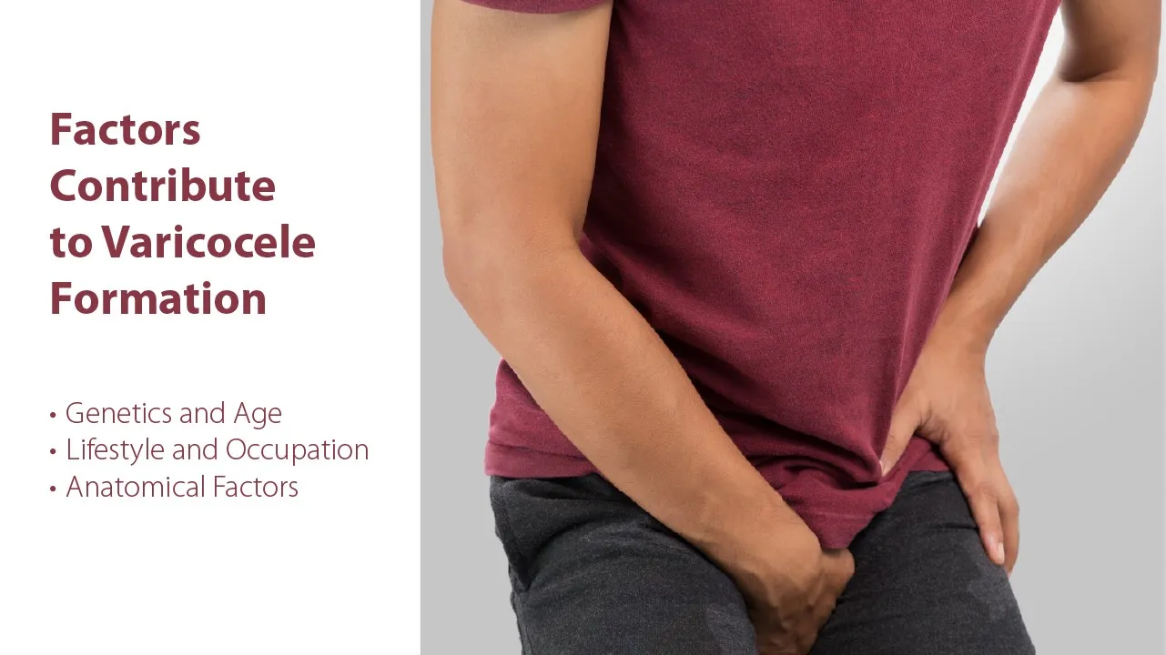 Varicocele Grading