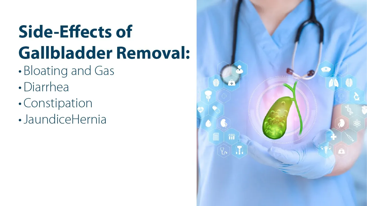 Side Effects of Gallbladder Removal