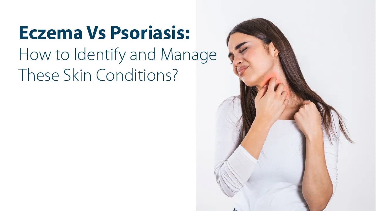 Eczema Vs Psoriasis: How to Identify and Manage These Skin Conditions?