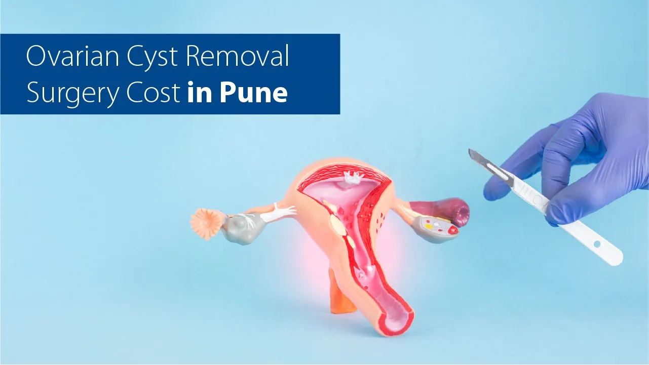 Ovarian Cyst Removal Surgery Cost in Pune