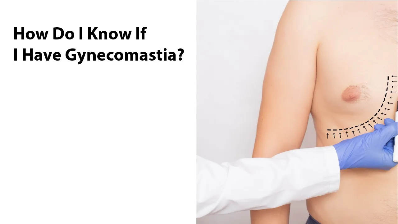 How Do I Know If I Have Gynecomastia?
