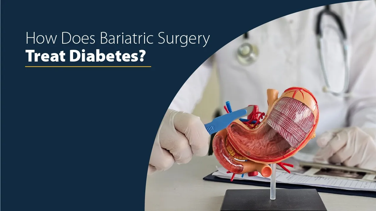 How Does Bariatric Surgery Treat Diabetes? 