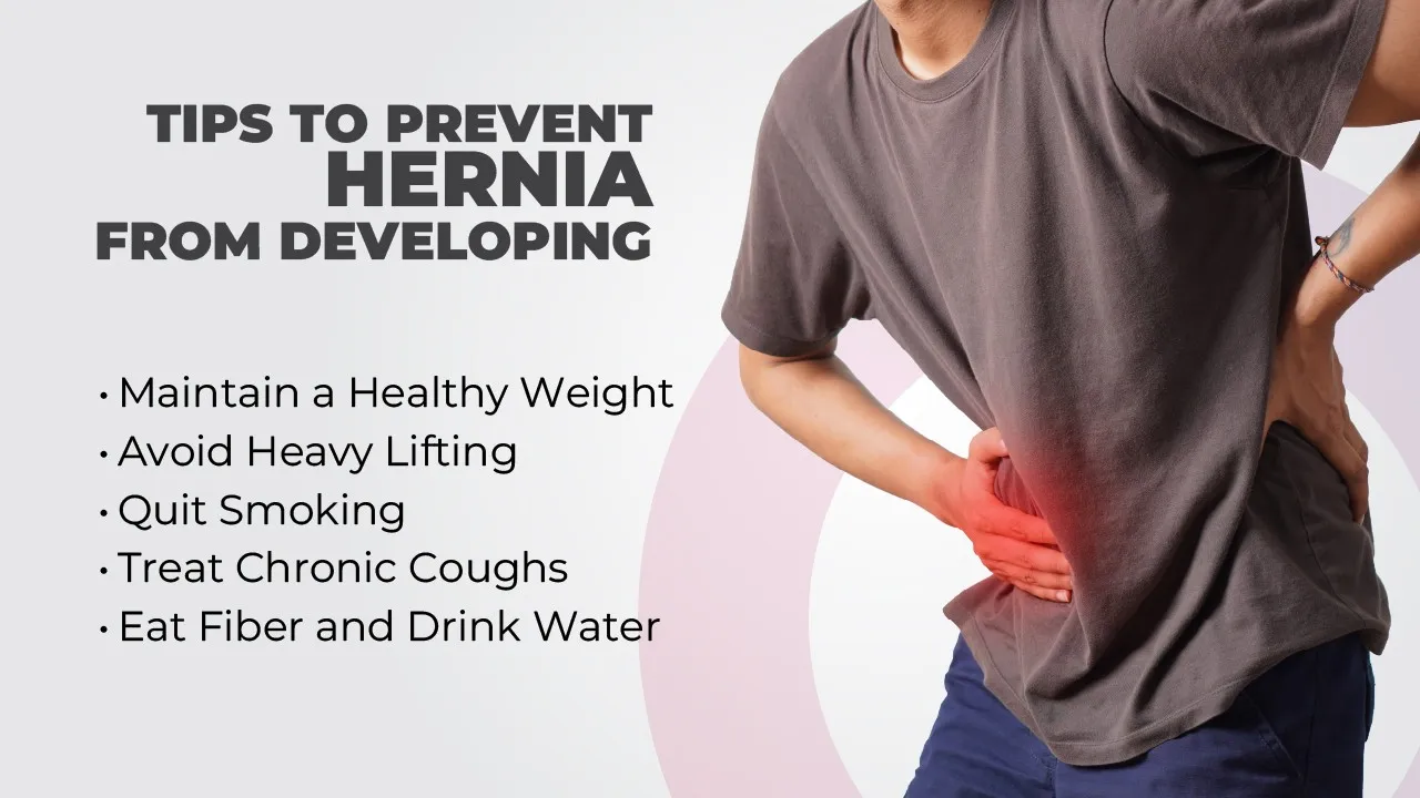 Top 10 Ways to Prevent a Hernia from Developing