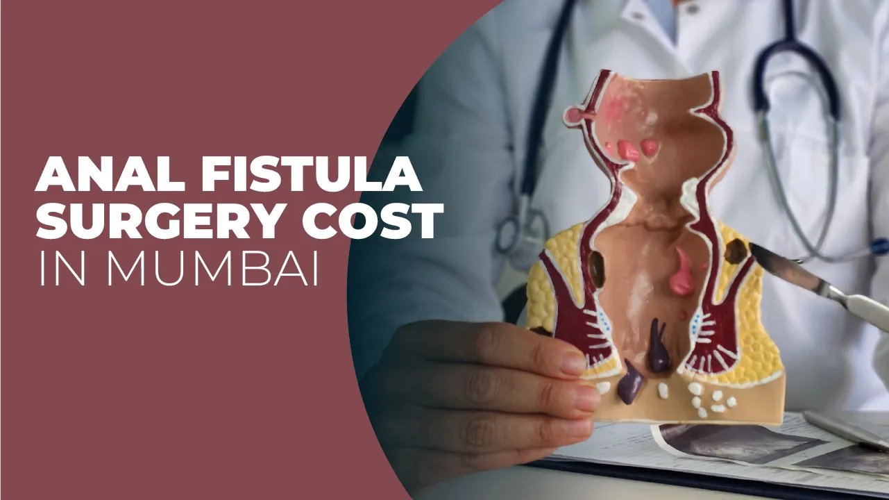 Anal Fistula Surgery Cost in Mumbai