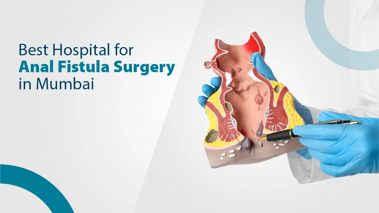 Best Hospital for Anal Fistula Surgery in Mumbai