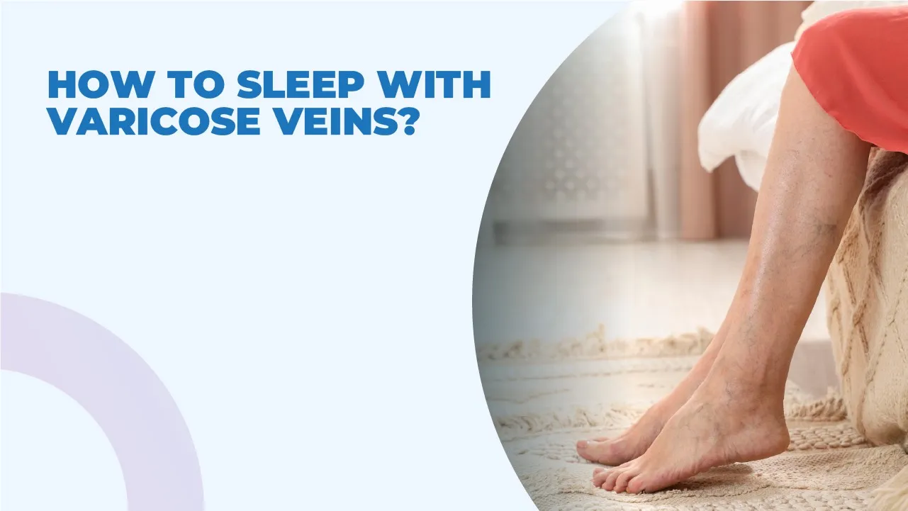 How To Sleep with Varicose Veins?