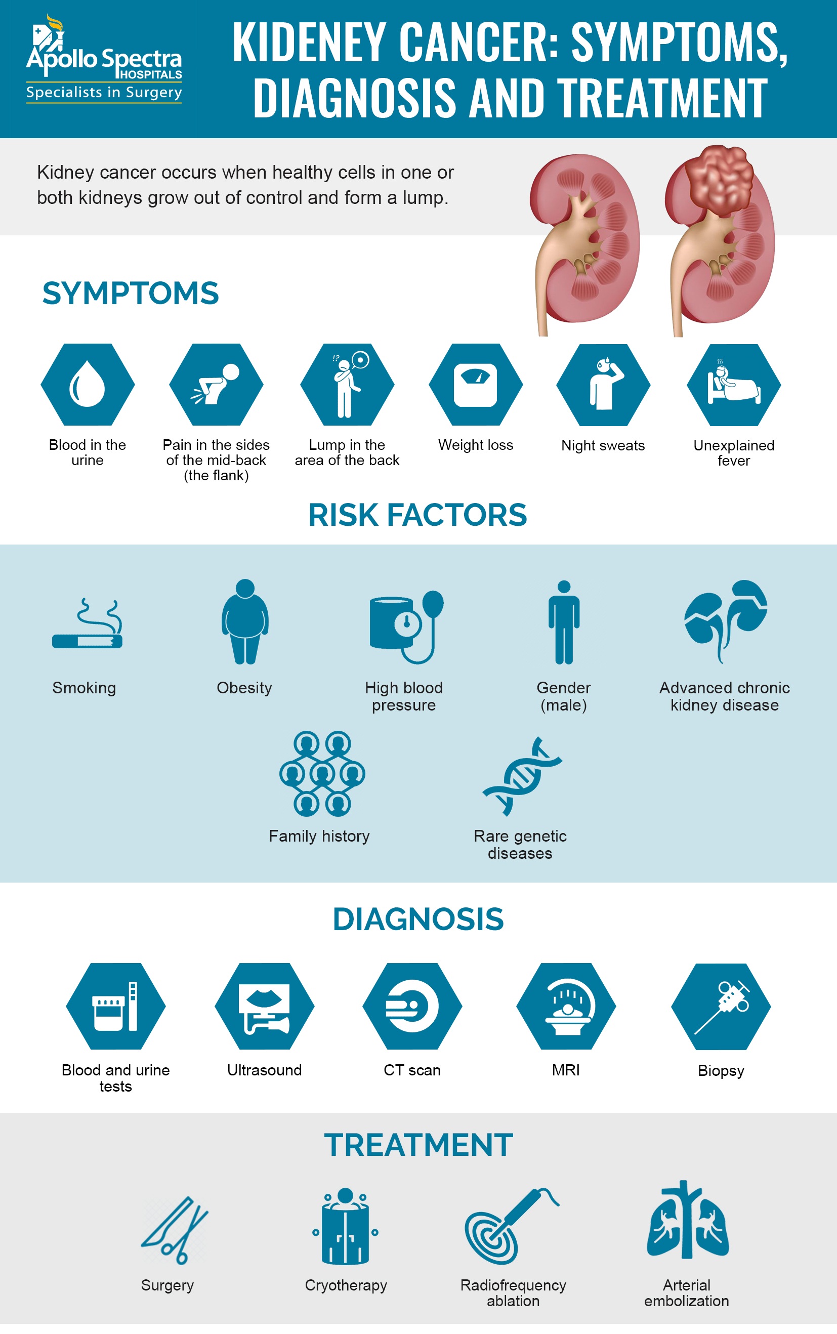 Flank Pain: Causes, Symptoms, Diagnosis & Treatments