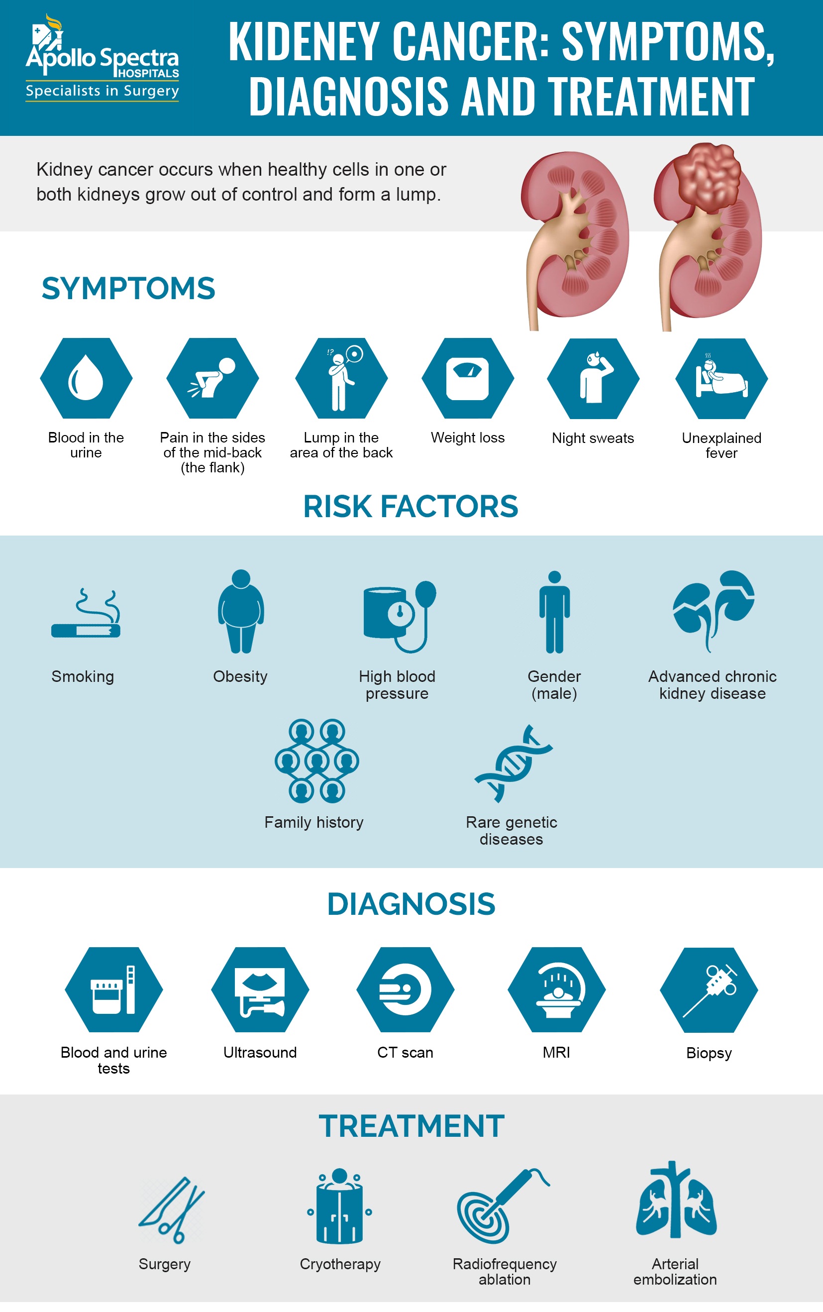 Kidney Pain Location