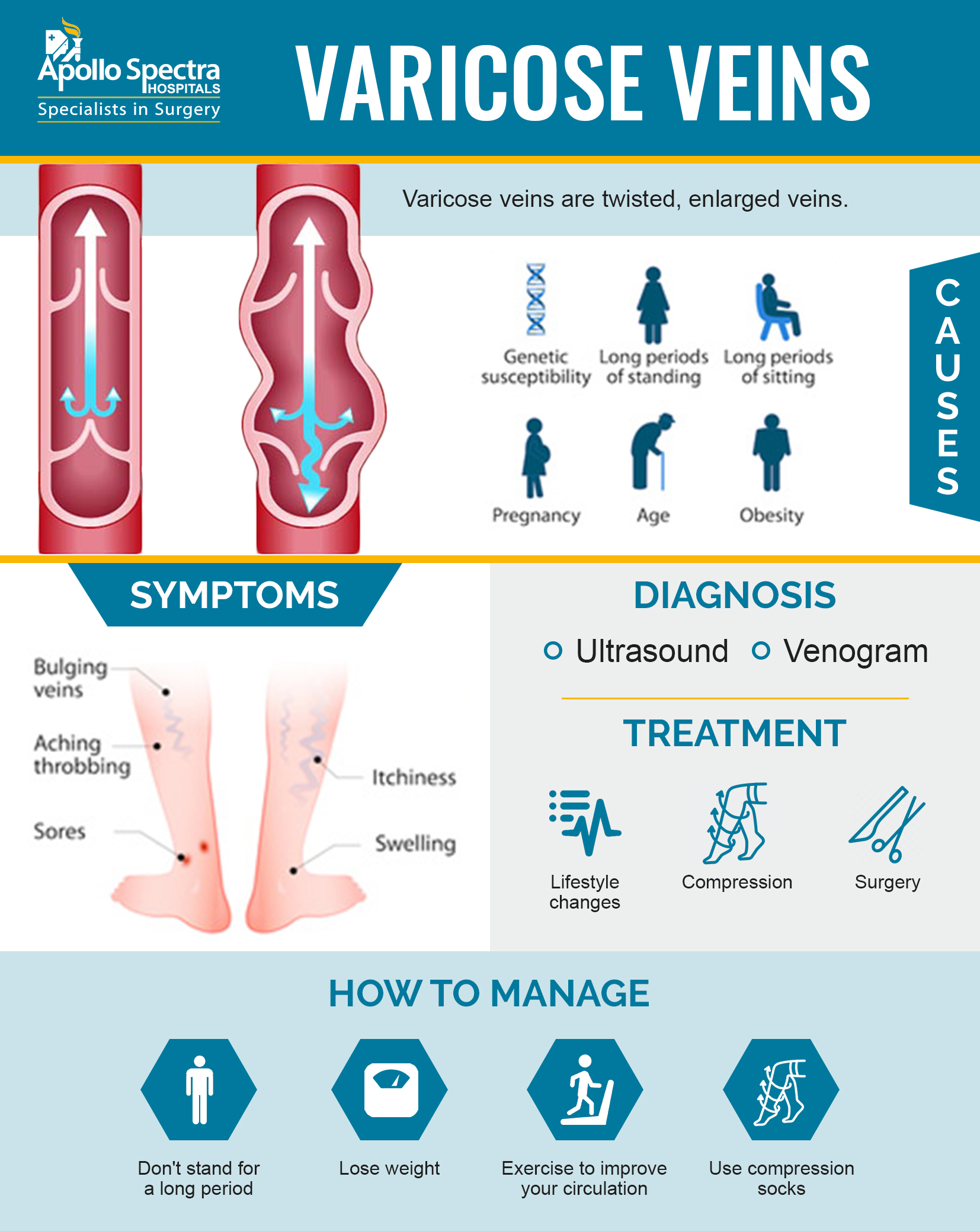 Varicose veins: Causes, treatment, diagnosis, and prevention