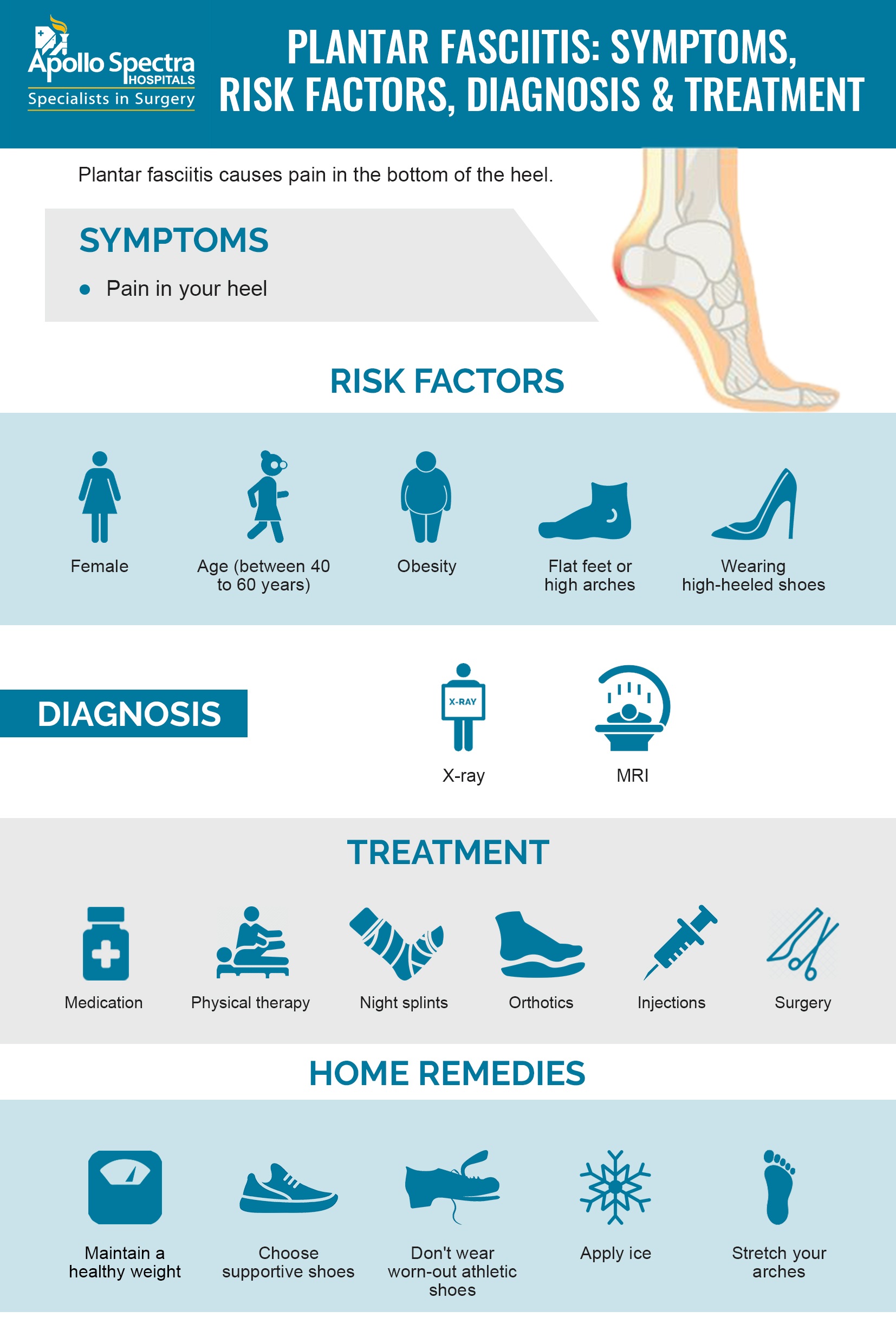 Plantar fasciitis - Diagnosis and treatment