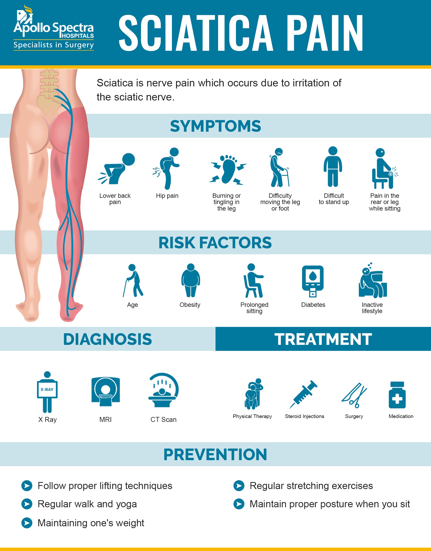 Sciatica: What It Is, Causes, Symptoms, Treatment & Pain Relief